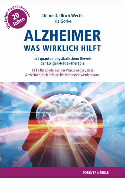 Buch Alzheimer - Was wirklich hilft